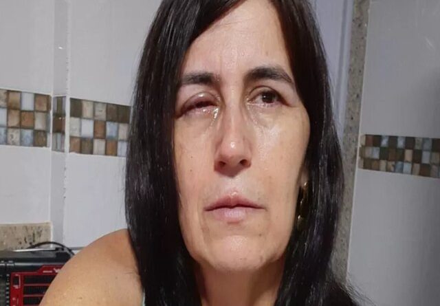Em vez de colírio, mulher recebe supercola no olho e é socorrida, no ES